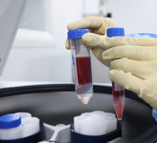 Blood Research